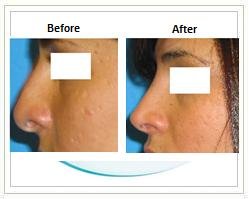 Slider image (4) Aesthetic Cosmetic Plastic Surgery Center Bolivia - SensualBodyDream